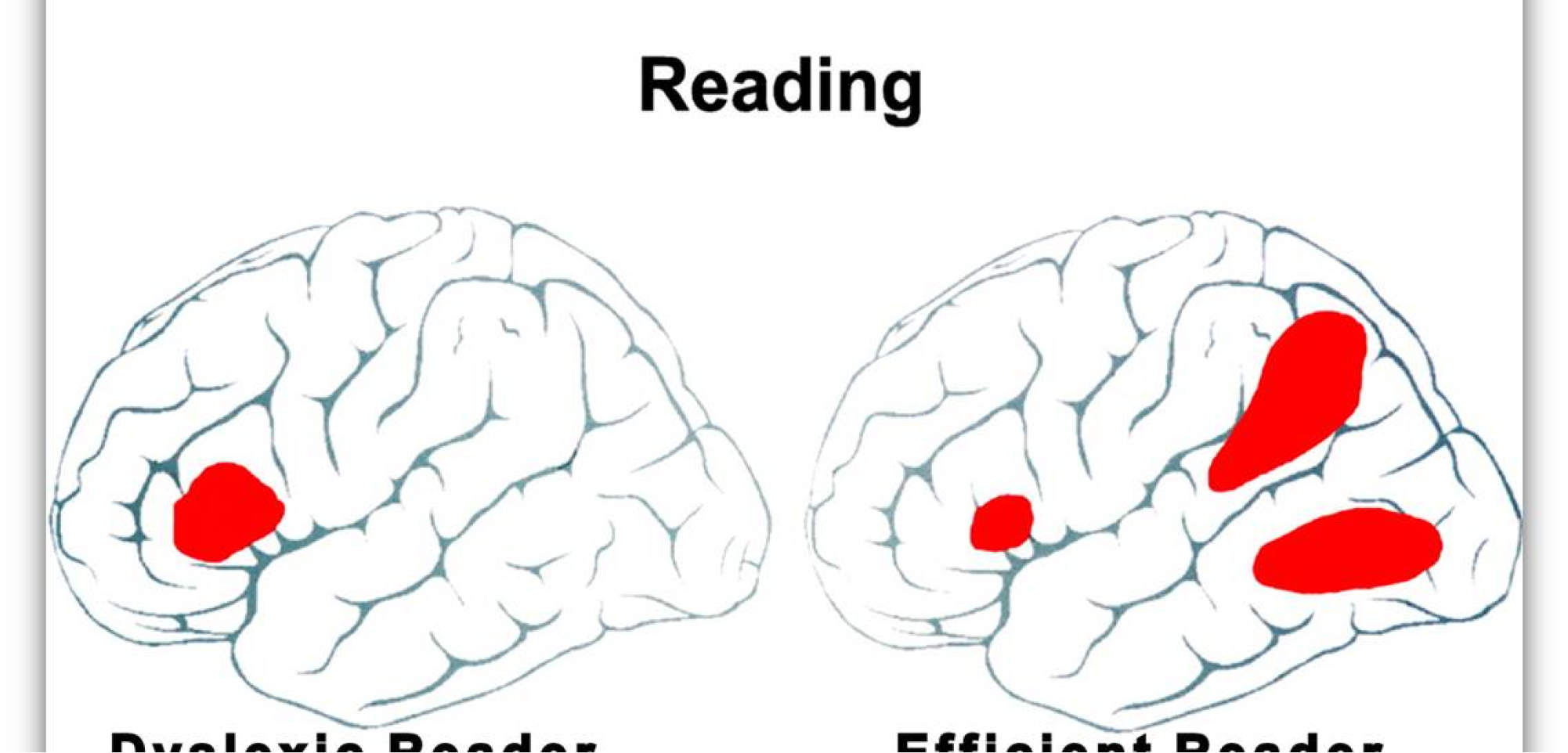 Brain Structure