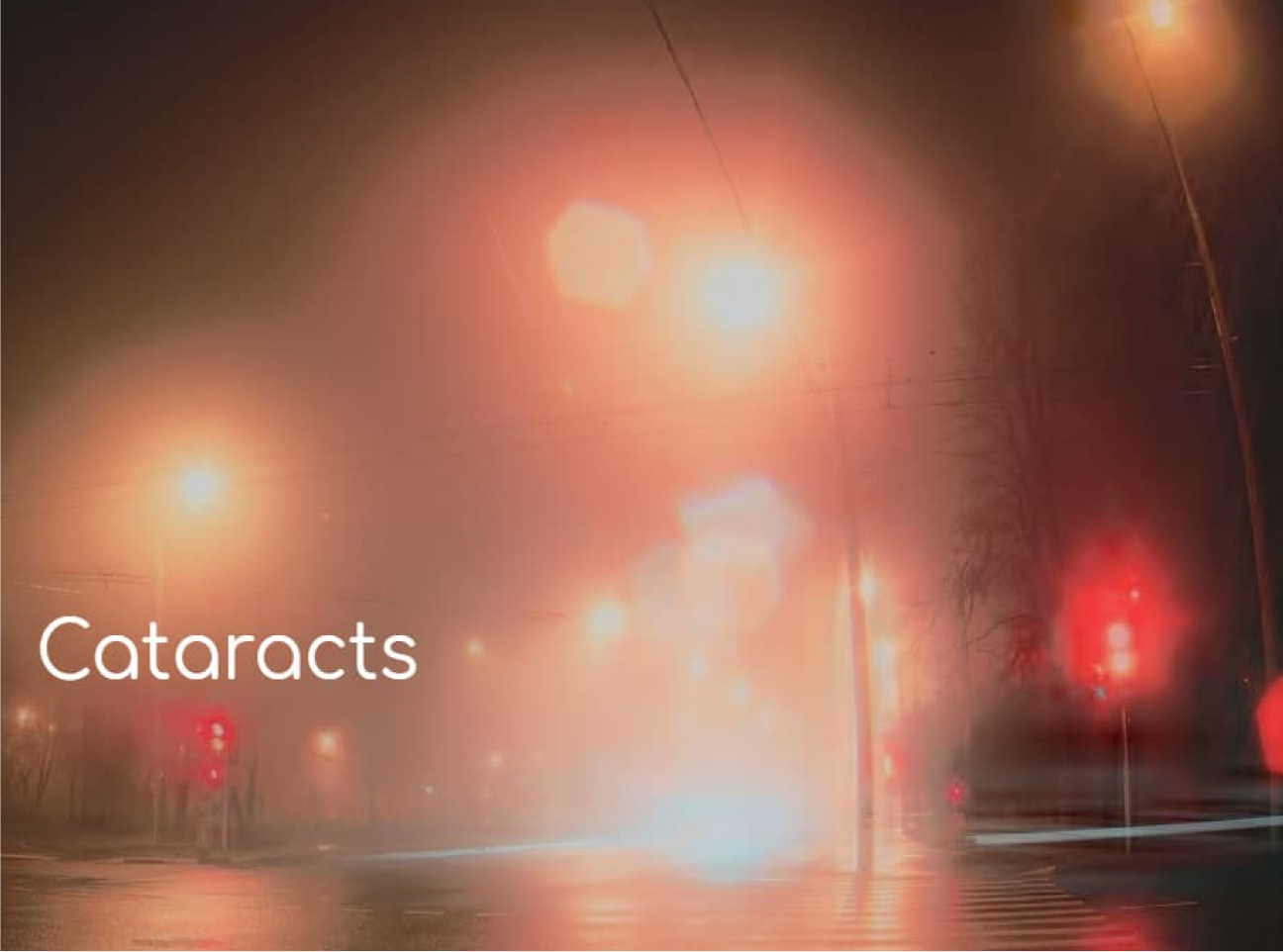 Cataracts
